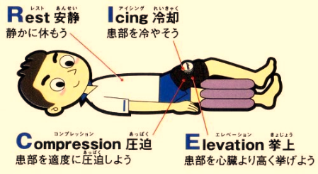 川﨑先生コラム 第22弾 ケガをしたら冷やすの 温めるの 柔道整復学科ブログ 柔道整復師 鍼灸師の日本医学柔整鍼灸専門学校柔道整復学科ブログ 柔道整復師 鍼灸師の日本医学柔整鍼灸専門学校